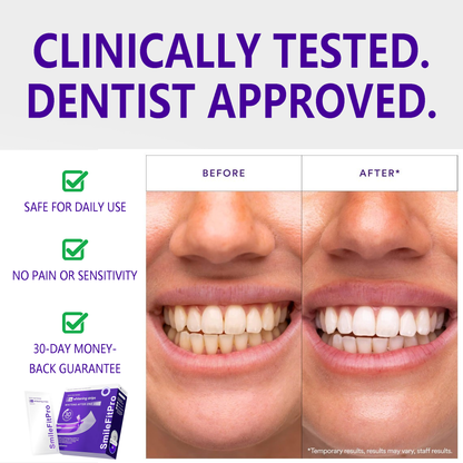 🦷🦷SmileFitPro™ V36 Whitening Strips – Professional Teeth Whitening at Home