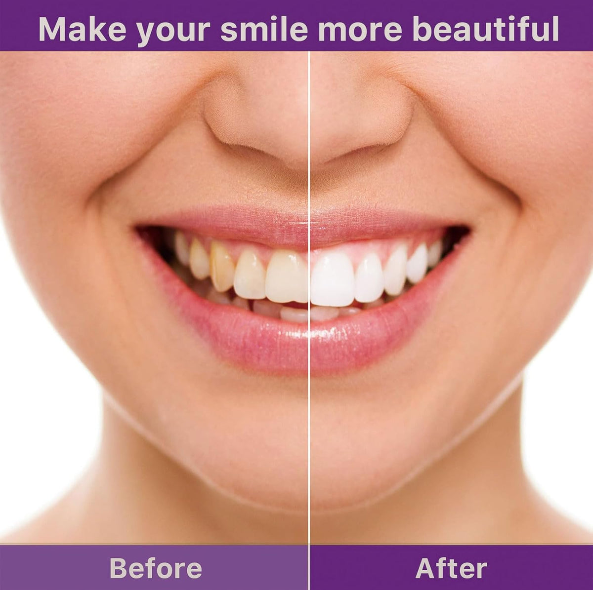 🦷🦷SmileFitPro™ V36 Whitening Strips – Professional Teeth Whitening at Home